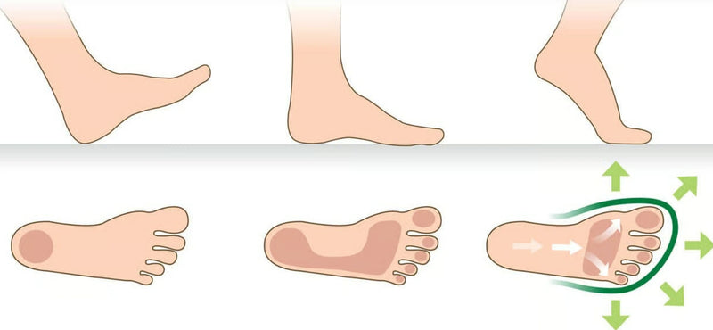 Linderung für jeden Fuß